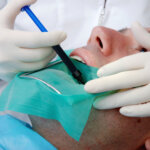 Dentist performing a root canal