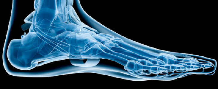 Xray scanning of a patient with hammertoe