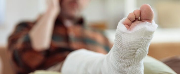 Man recovering on the couch after a bunion surgery